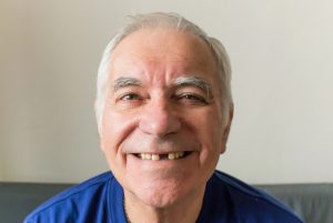smiling man with missing tooth