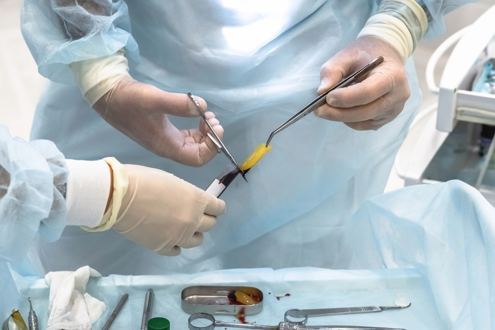 practitioner working with platelet-rich firbin